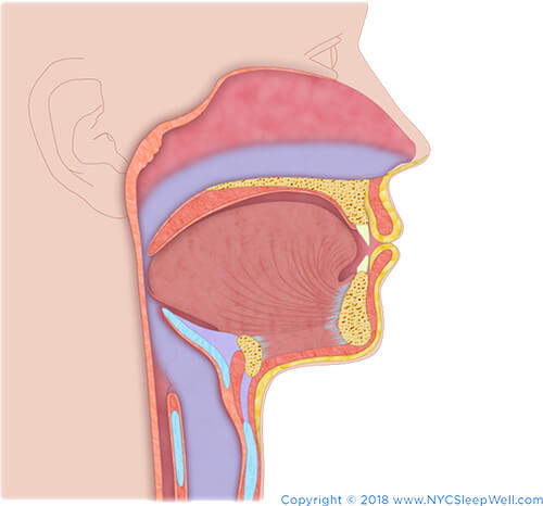 Frenectomy - Tongue Tie & Sleep Apnea | NYC Sleepwell